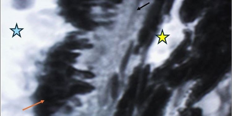 Journal of Aging Research and Healthcare - Berlin´s edema