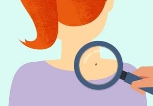 Journal of Skin Cancer Epidemiology