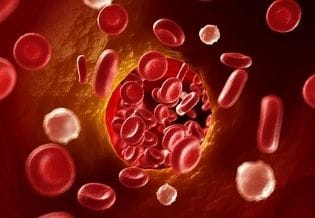 Journal of Thrombosis and treatments