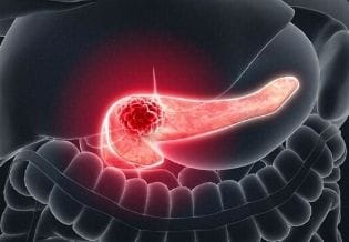Journal of Pancreas