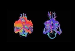 International Journal of Neuroimaging
