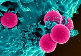 Journal of Neoplasms 